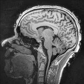 Oliver's MRI Image